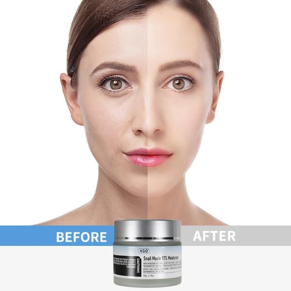 VGO Snail Mucin 92% Moisturizer Daily Face Moisturizer Hydrating Repair Face Gel Cream for Dry & Sensitive Skin, All Skin Types 50g / 1.76oz - Image 6